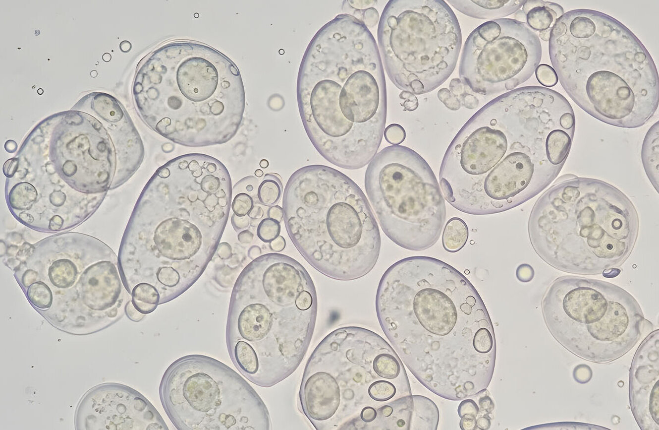 yeast cells under microscope, oval microbial culture 