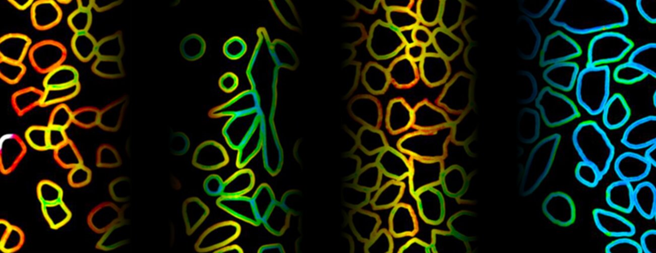 Semi-artistic composite of different microscopy images of cells marked with FMR dyes