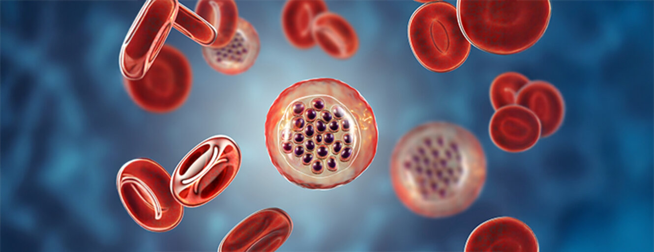 3D illustration of malaria-infected red blood cells showing malaria parasite Plasmodium falciparum in schizont stage inside red blood cells