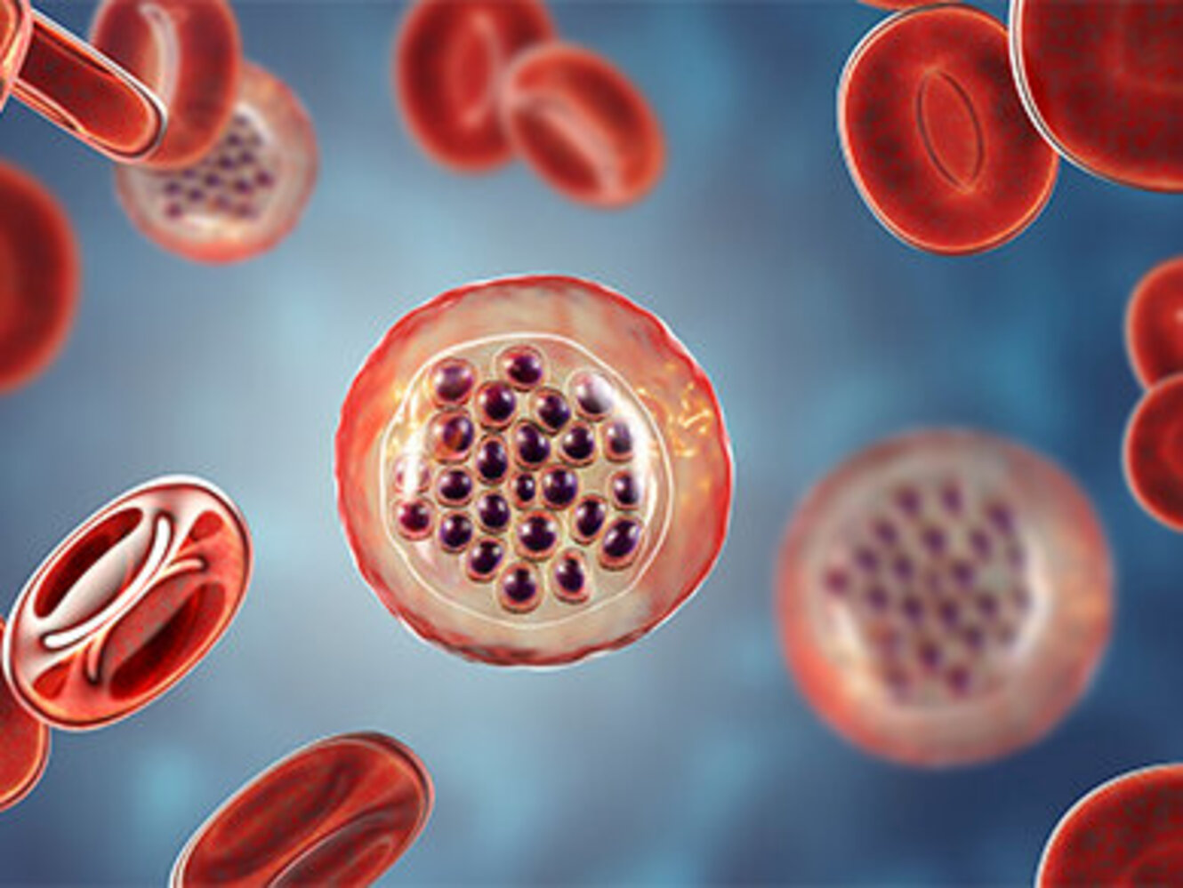 3D illustration of malaria-infected red blood cells showing malaria parasite Plasmodium falciparum in schizont stage inside red blood cells